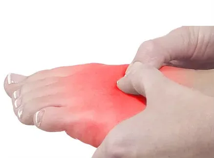 Tratamento de Neuroma